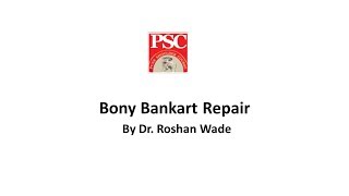 Bony Bankart Repair By Dr Roshan Wade [upl. by Dieterich]