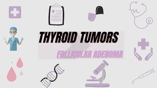 Thyroid Tumors Follicular Adenoma Definition Morphological features Diagnosis Treatment [upl. by Nekcerb]