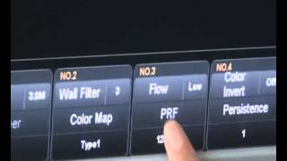 Chison i3 4D Color Doppler Ultrasound  Training Video 1 [upl. by Shaina]