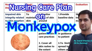 Nursing Care Plan On Monkeypox Nursing care plan for Monkeypox nursingcareplan monkeypox [upl. by Sutelc]