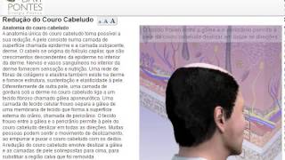 Redução do Couro Cabeludo  Cirurgia Plástica  Dr Davi Pontes  Fortaleza  Natal  São Luís [upl. by Ymmot817]