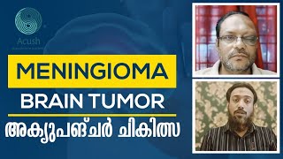 Meningioma Brain Tumor Acupuncture Treatment Success Story Patient’s Testimonial Malayalam [upl. by Nyledam]