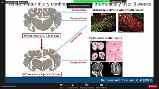 Tertiary White Matter Injury and Circadian Disruption after HypoxiaIschemia at Preterm Gestation [upl. by Suiratnod]