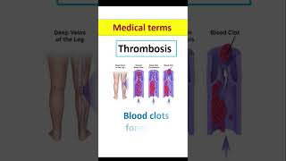 Common medical terms  Medical terminology medicine pharmacy medicalabbreviations pharmacology [upl. by Akienaj409]