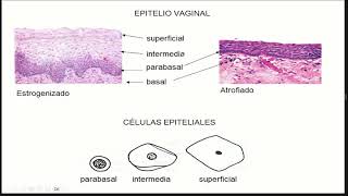 cérvico vaginitis [upl. by Persons]