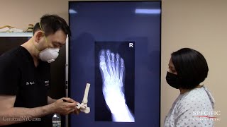 RSD CRPS in Foot HELPED by Dr Suh Gonstead Chiropractic NYC Manhattan Midtown [upl. by Shank756]