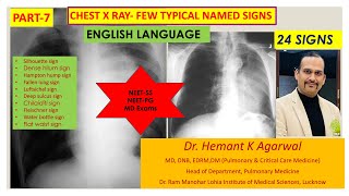 Chest X Ray7 Typical Named Sign ENGLISH Pulmonary Radiology NEETSS Pulmonary Medicine Hemant [upl. by Adnohsor]