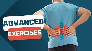 Spondylolisthesis ADVANCED EXERCISES for active people [upl. by Ramu]