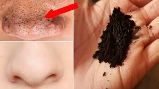 How to Remove Blackheads from Nose  Face Hindi [upl. by Naeruat]