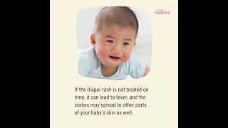 How to Spot and Treat Diaper Rash [upl. by Cooper]