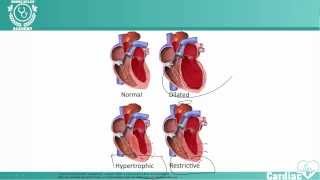 Cardiomyopathy  NCLEX® Cardiac Review  NURSINGcom NRSNG Academy [upl. by Katleen]