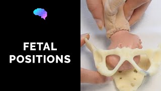 Types of Fetal Positions  OSCE Guide  UKMLA  CPSA [upl. by Georges]