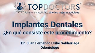 Implantes Dentales ¿En qué consiste este procedimiento [upl. by Jehias237]