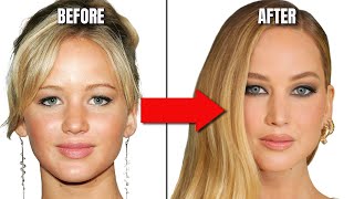 Jennifer Lawrences Plastic Surgeries The High Cost of Perfection [upl. by Prosper]