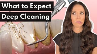 What To Expect From a DEEP Cleaning at the Dentist [upl. by Arline]