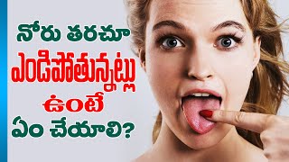 Dry Mouth CausesSymptoms and Treatment How to cure Dry Mouth Telugu Health Tips  Uhealth [upl. by Damle600]