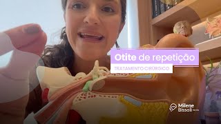 Cirurgia como tratamento da Otite de Repetição [upl. by Dilly]