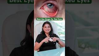 Best Eye Drops for Red Eyes  Redness Relief Eye Drops  ytshort youtube [upl. by Liew]