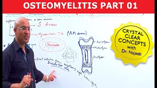 Osteomyelitis  Symptoms amp Causes🩺 [upl. by Steddman879]