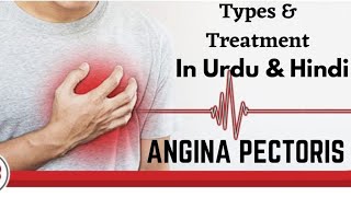 Types and Treatment of Angina Pectoris in UrduHindi By Dr Zahid Ali [upl. by Imoyik]