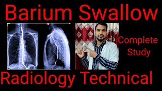 Barium swallow Test  Indication Contraindication Procedure  complete study  By BL KumawatI [upl. by Amairam]