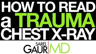 How to Read a Trauma Chest Xray in 3 Minutes [upl. by Yanffit]