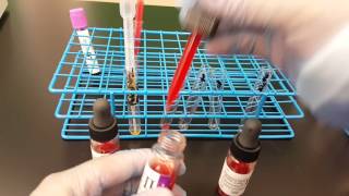 Blood Banking Antibody Screen Set up Part 1 [upl. by Gierk517]