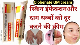 Clobenate GM cream  Clobenate GM cream uses in Hindi  दादखाजखुजली और दाग धब्बों पर असरदार क्रीम [upl. by Eatnoj]