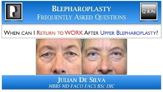 Upper Blepharoplasty Recovery Returning to Work after Upper Eyelid Lift Surgery [upl. by Barry14]