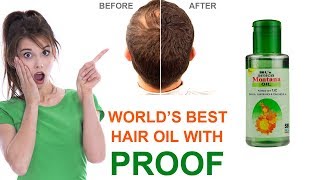 Arnica montana hair oil benefits  arnica montana hair oil effect  Arnica montana oil and shampoo [upl. by Attalie]