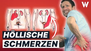 Nierensteine amp Koliken stoppen Typische Ursachen und 5 Tipps für Deine Nierengesundheit [upl. by Arabrab620]