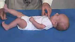 Neurology Exam 3 Month Primitive ReflexesRoot [upl. by Nosmoht]