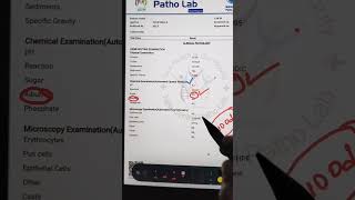 Urine Test In Hindi  Urine Test Report  UrineTest Analysis  Urine Test Report Kaise Dekhehba1c [upl. by Billie482]