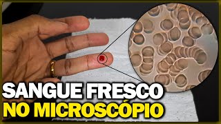 Analisando sangue fresco no microscópio [upl. by Eintirb]