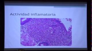 Enfermedad Inflamatoria Intestinal  Patología [upl. by Nyrek131]