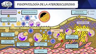 FISIOPATOLOGIA DE LA ATEROESCLEROSIS  Morfofisiología [upl. by Waechter]