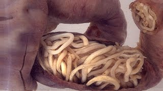 Top 10 Human Intestine Parasites Narrated [upl. by Byrann]