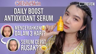 ELSHESKIN DAILY BOOST ANTIOXIDANT SERUM REVIEW  VITAMIN C 15 [upl. by Philemol]