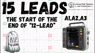 Back to the Basics EKG Review 15 leads [upl. by Knowling]