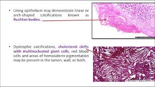 ORALPATH CHAP3 PART2 ODONTOGENIC CYSTS AND TUMOURSENGLISH [upl. by Jarrid]