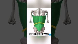 Why Anterior Pelvic Tilt Is So Misunderstood do this to fix it posture lowbackpain backpain [upl. by Noj]