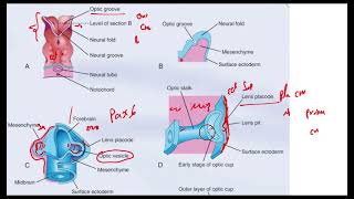 Placoda del Cristalino Embriología Ojo [upl. by Chaudoin]