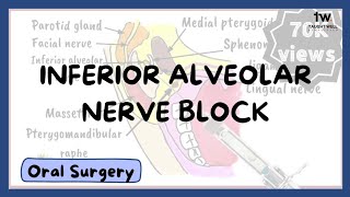 Inferior Alveolar Nerve Block Technique [upl. by Asseniv453]