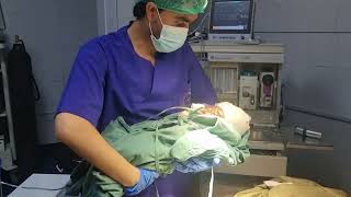 baby come out anesthesia craniosynostosis operation [upl. by Dash]