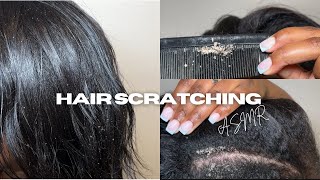 Scalp scratching ASMR Flakes Scalp psoriasis [upl. by Claribel]