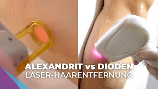 LaserHaarentfernung Alexandrit vs Dioden für Ästhetik welche Unterschiede [upl. by Oinegue]