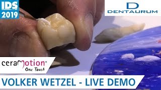 Einfache und Ästhetische Finalisierung mit ceraMotion® One Touch I IDS 2019 [upl. by Indihar]