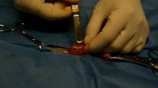 Ovarian Cyst in 5 Month Old Cat Being Spayed [upl. by Ataner]