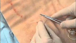 8 Common Suture Techniques for Skin Closure [upl. by Caine]