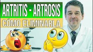 Artritis amp Artrosis  Síntomas causas amp Cómo eliminarla [upl. by Marciano]